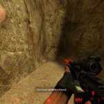 Burnt_skin_and_hands_v1