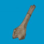 bt femur broken